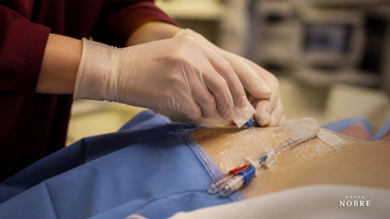 Infecção de corrente sanguínea no PICC: como prevenir